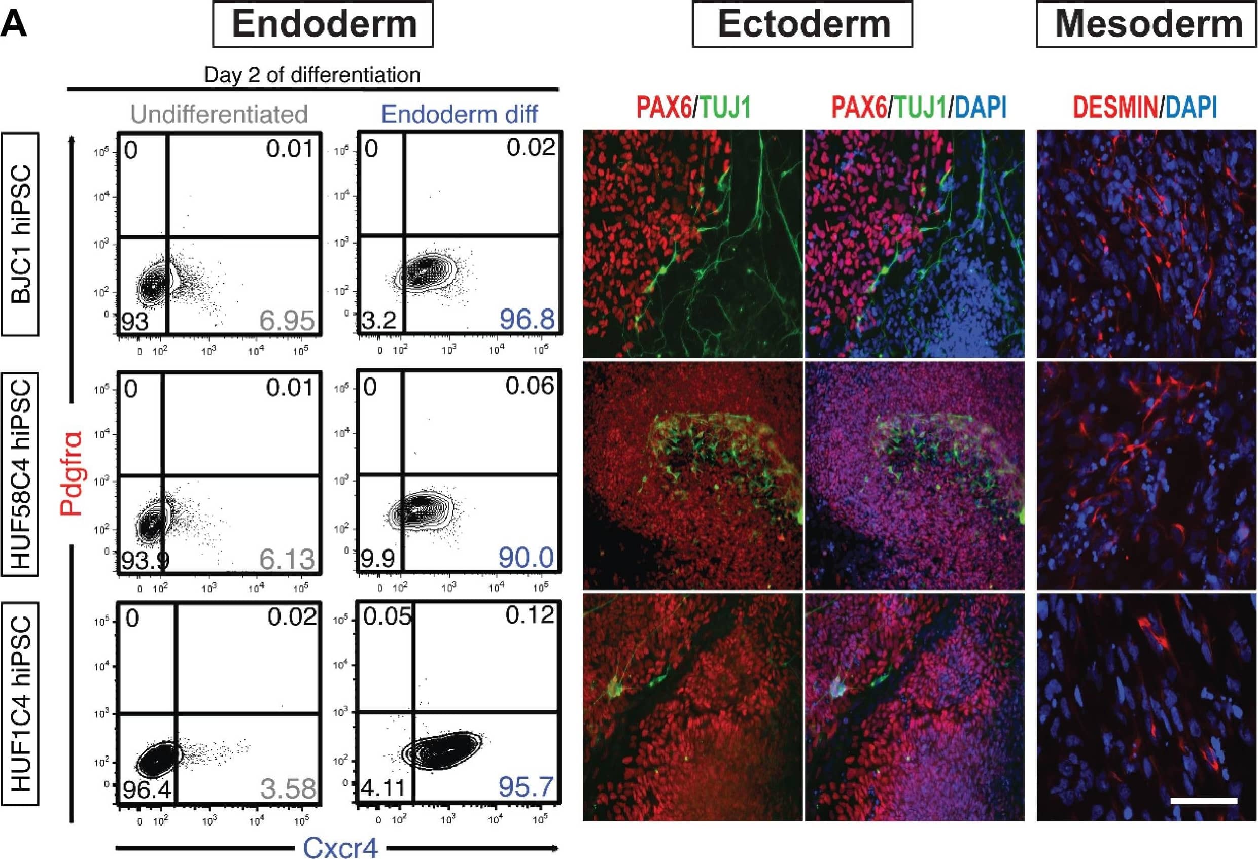 Detection of Human Desmin by Immunocytochemistry/Immunofluorescence
