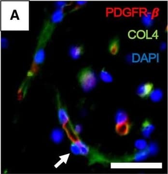 Detection of Mouse PDGF R beta by Immunohistochemistry