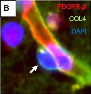 Detection of Mouse PDGF R beta by Immunohistochemistry