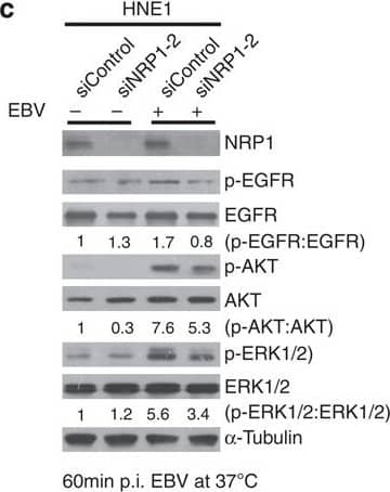 Detection of Human Neuropilin-1 by Knockdown Validated