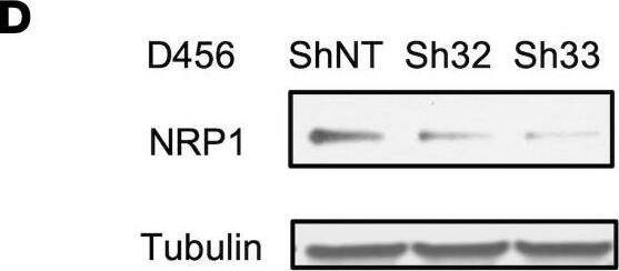 Detection of Human Neuropilin-1 by Western Blot