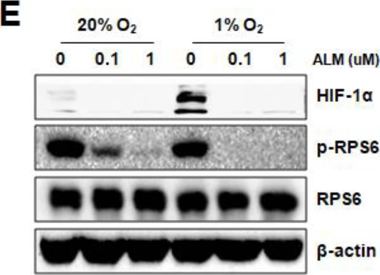 Detection of Human Ribosomal Protein S6/RPS6 by Western Blot