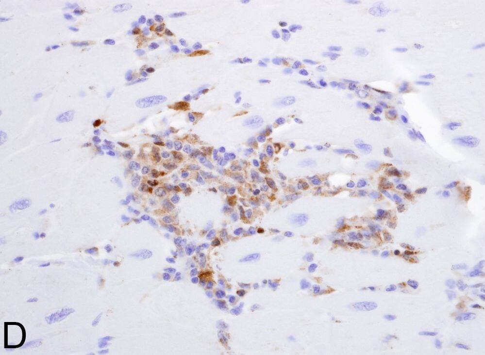 Detection of Human CXCL9/MIG by Immunohistochemistry