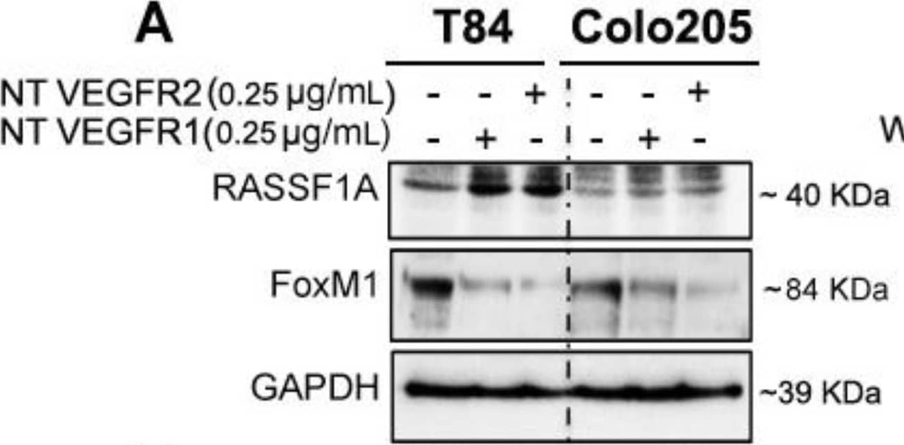 Detection of Human FoxM1 by Western Blot