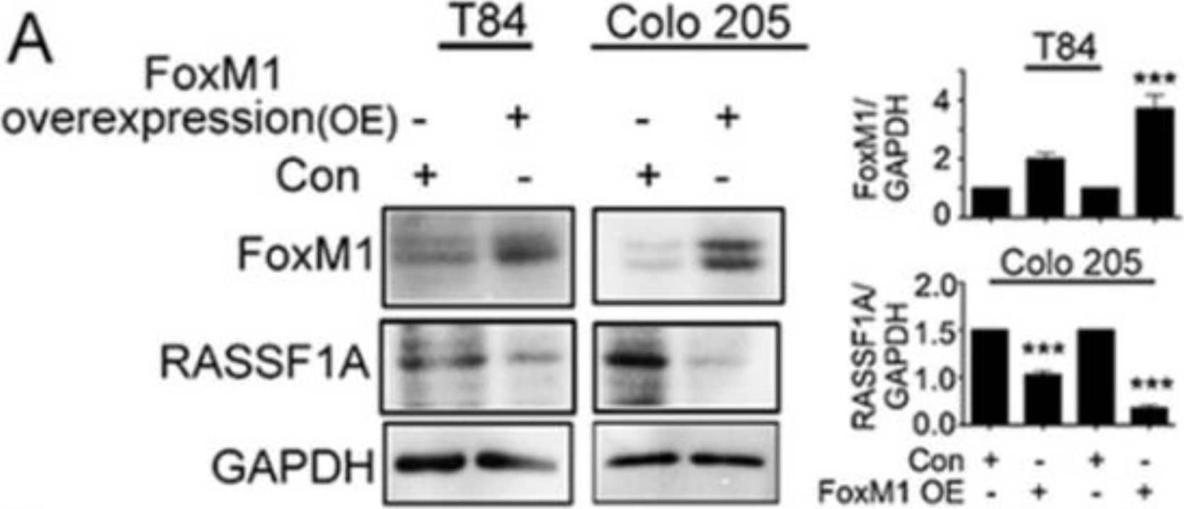 Detection of Human FoxM1 by Western Blot