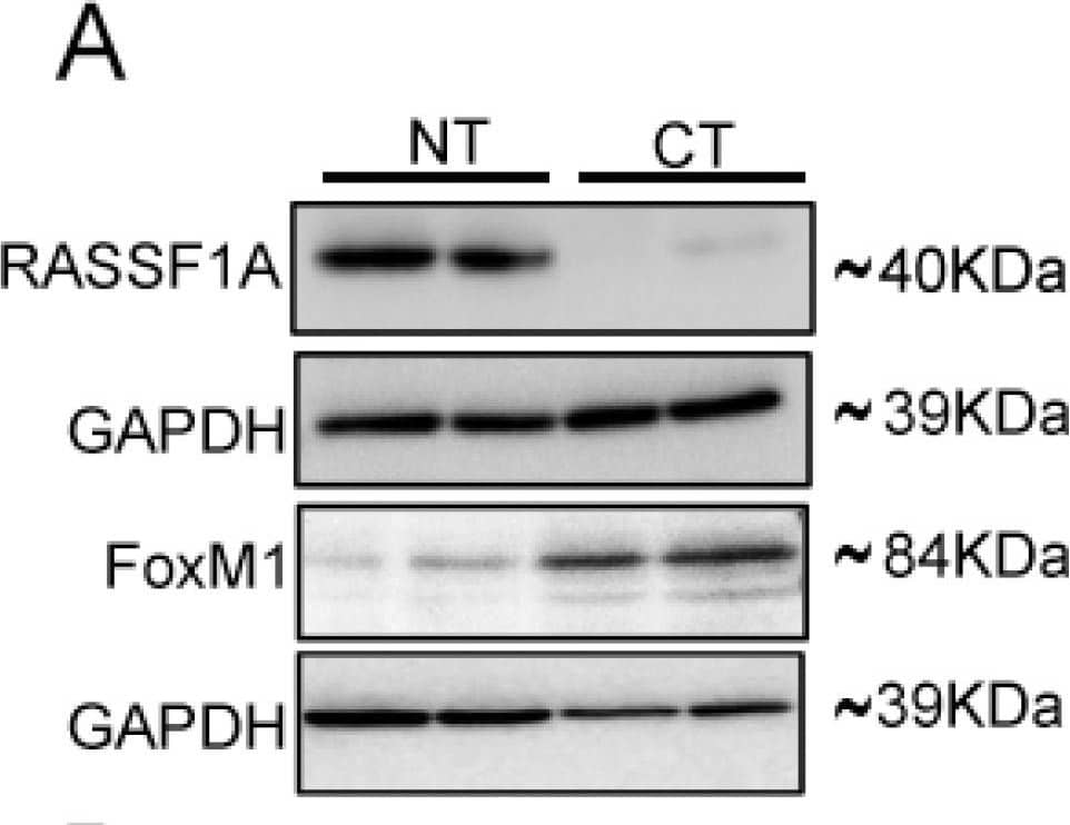 Detection of Human FoxM1 by Western Blot