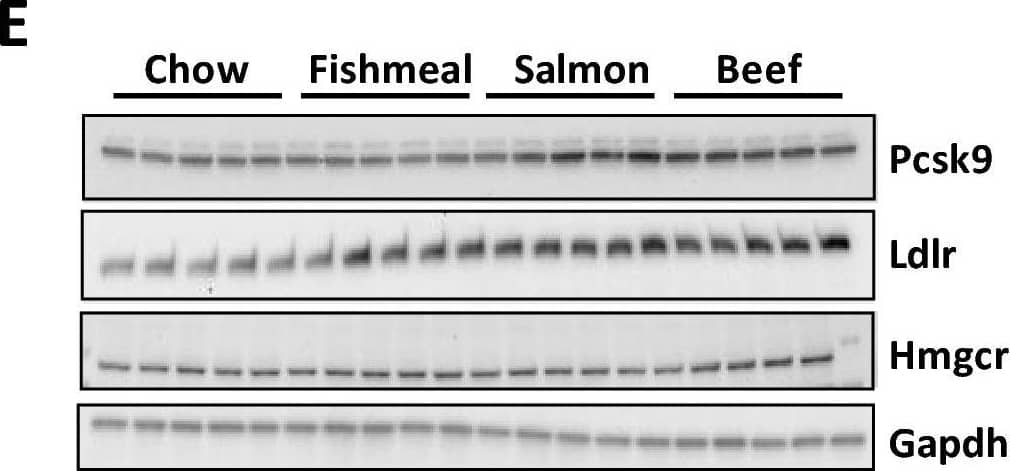 Detection of Proprotein Convertase 9/PCSK9 by Western Blot