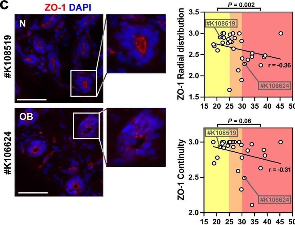 Detection of Leptin/OB by Immunocytochemistry/ Immunofluorescence