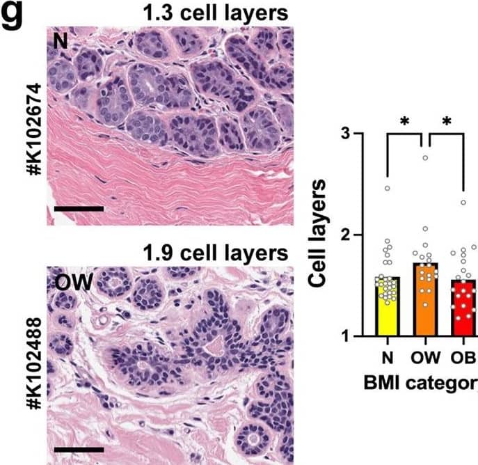 Detection of Leptin/OB by Immunohistochemistry