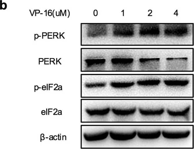Detection of Human PERK by Western Blot