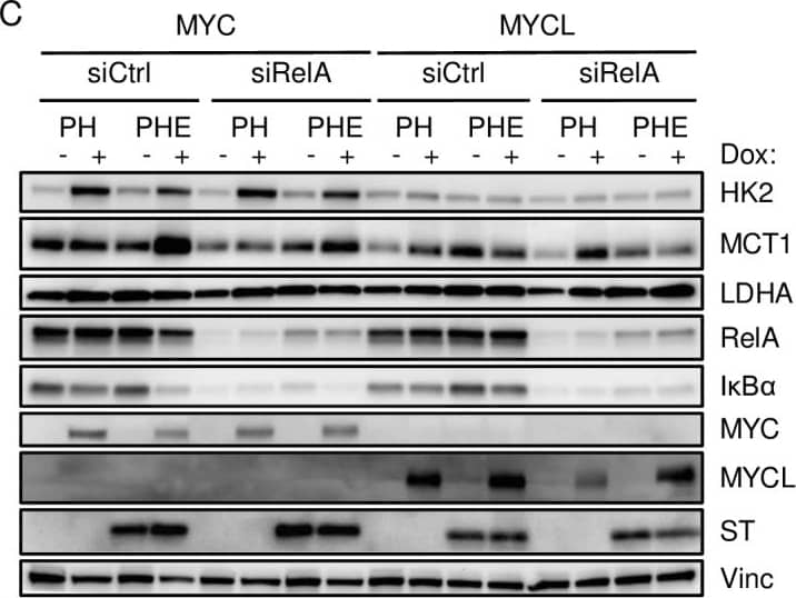 Detection of Human MYCL1/L‑Myc by Western Blot