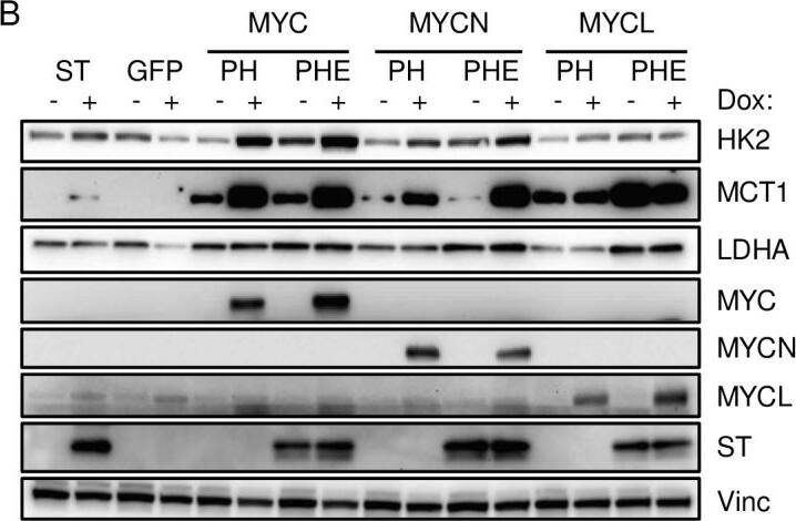 Detection of Human MYCL1/L‑Myc by Western Blot