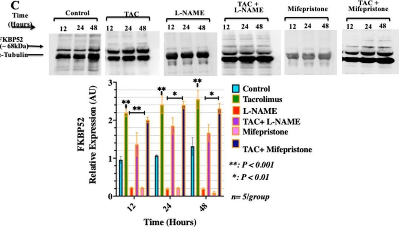 Detection of FKBP52 by Western Blot