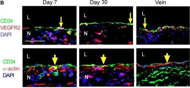 Detection of Rat CD34 by Immunohistochemistry