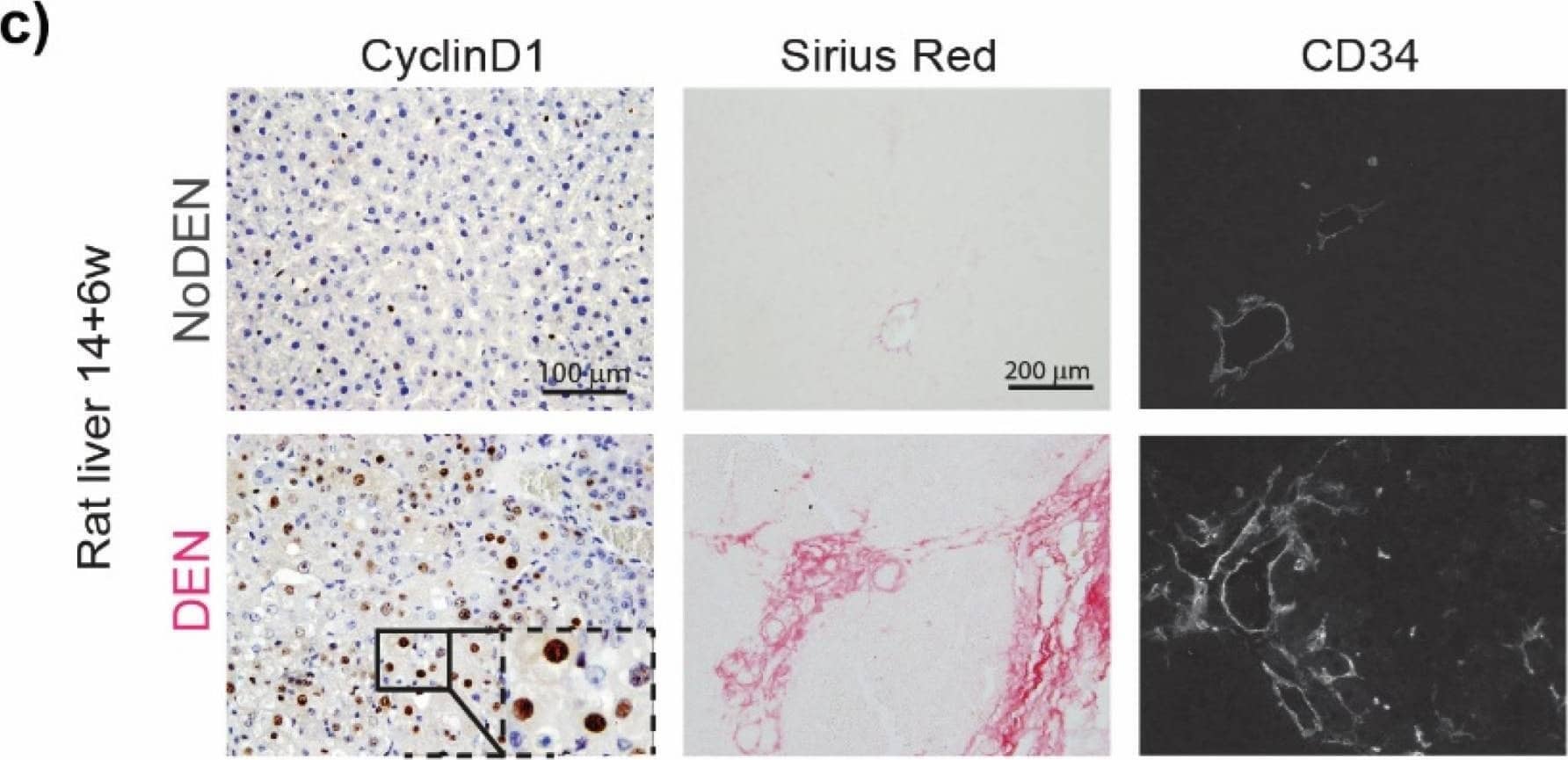 Detection of CD34 by Immunohistochemistry