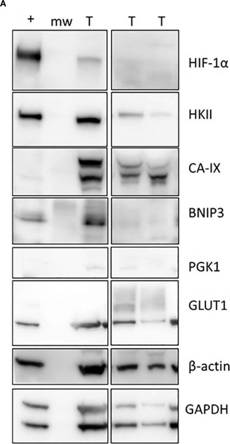 Detection of BNIP3 by Western Blot