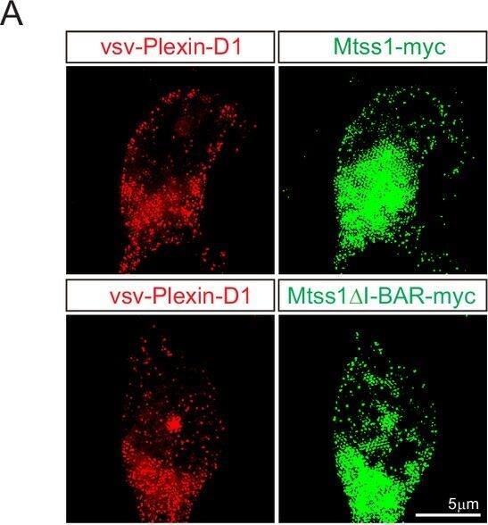 Detection of Mouse Plexin D1 by Immunohistochemistry