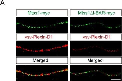 Detection of Mouse Plexin D1 by Immunohistochemistry
