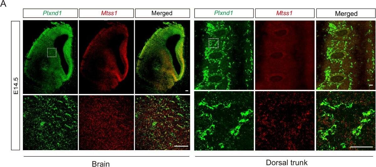 Detection of Mouse Plexin D1 by Immunohistochemistry