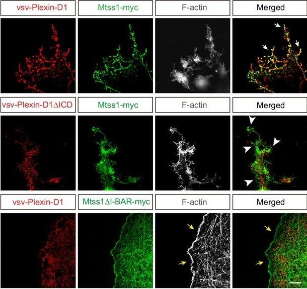 Detection of Mouse Plexin D1 by Immunohistochemistry