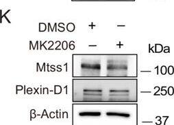 Detection of Plexin D1 by Western Blot