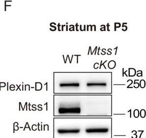 Detection of Plexin D1 by Western Blot