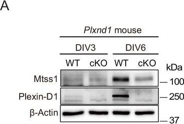 Detection of Plexin D1 by Western Blot