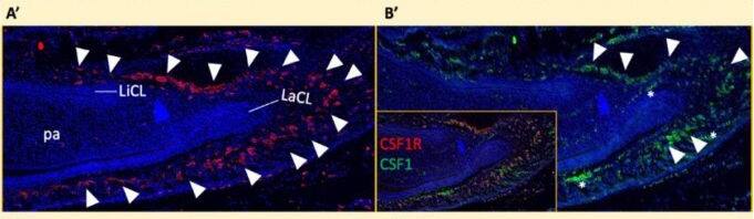 Detection of M-CSF by Immunohistochemistry