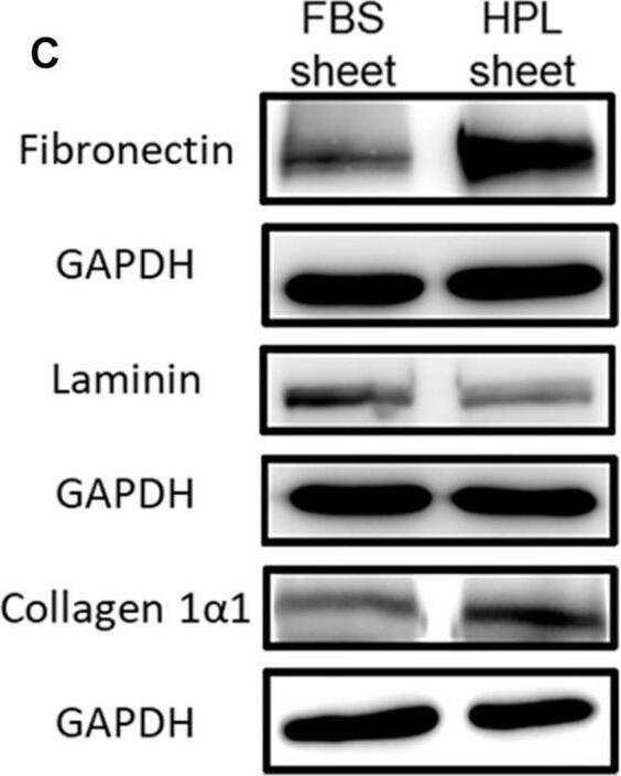 Detection of Laminin alpha 1 N-Terminus Domain VI by Western Blot