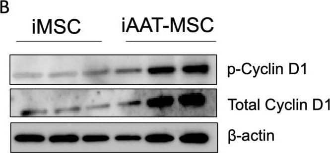 Detection of Human Cyclin D1/D2 by Western Blot