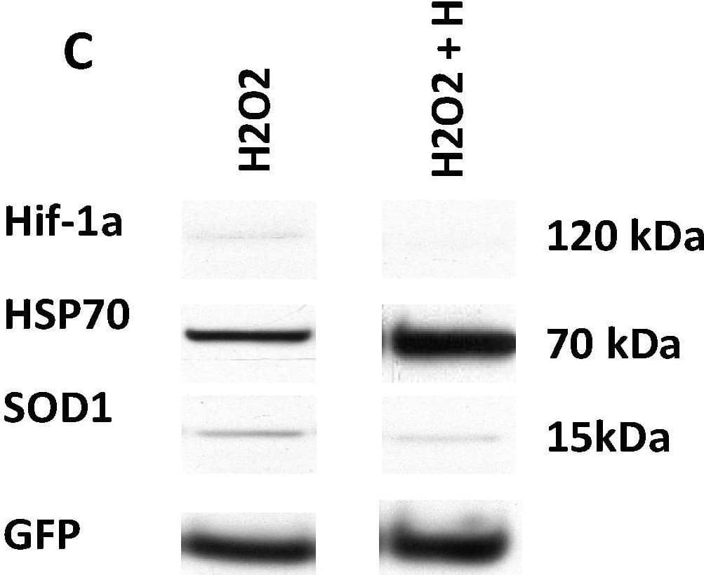 Detection of GFP by Western Blot