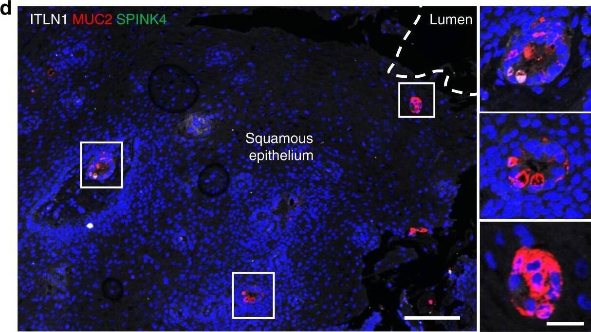 Detection of Human Intelectin-1/Omentin by Immunocytochemistry/Immunofluorescence