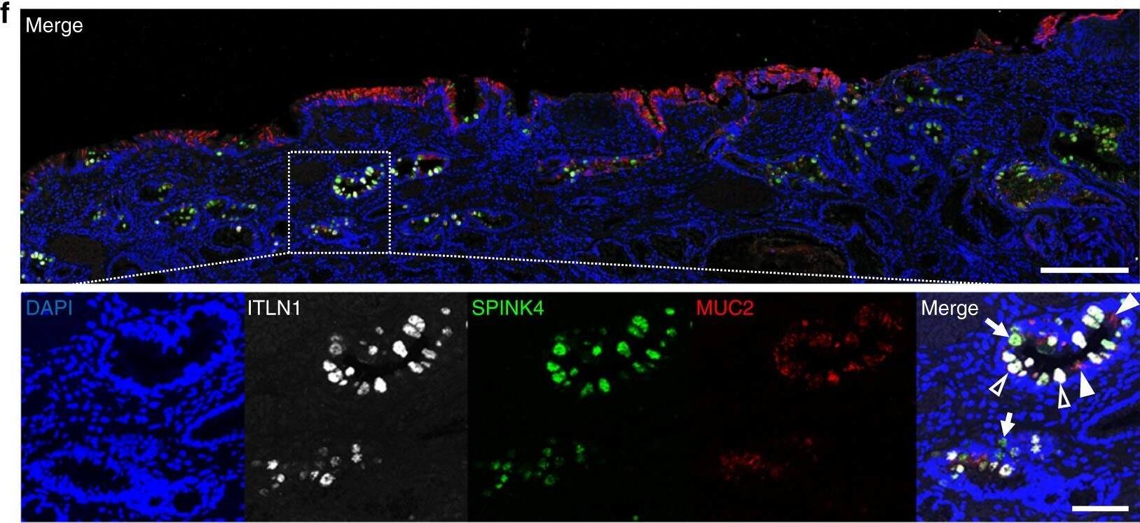 Detection of Human Intelectin-1/Omentin by Immunocytochemistry/Immunofluorescence