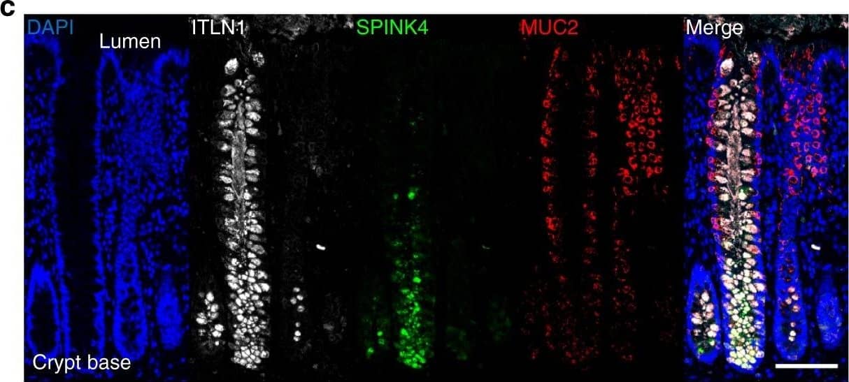 Detection of Human Intelectin-1/Omentin by Immunocytochemistry/Immunofluorescence