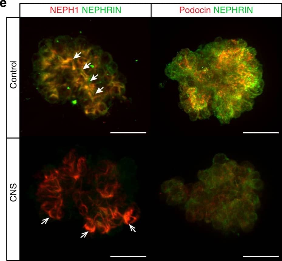 Detection of Human Nephrin by Immunocytochemistry/Immunofluorescence
