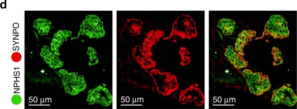 Detection of Human Nephrin by Immunohistochemistry