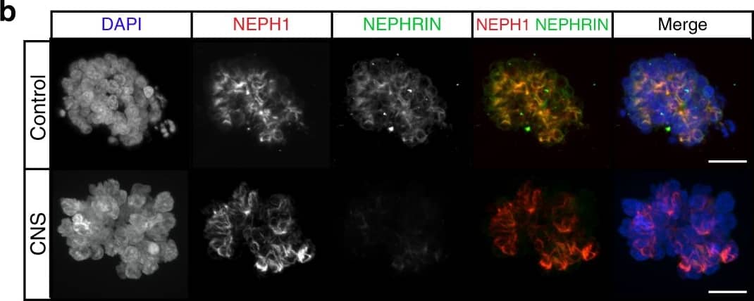 Detection of Human Nephrin by Immunocytochemistry/Immunofluorescence