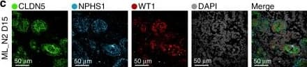 Detection of Human Nephrin by Immunocytochemistry/Immunofluorescence