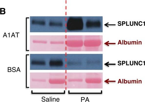 Detection of Mouse PLUNC by Western Blot