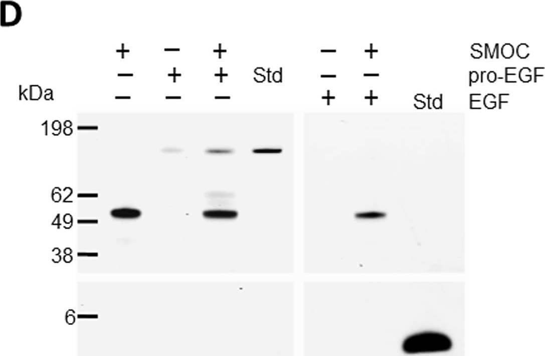 Detection of Pro-EGF by Western Blot