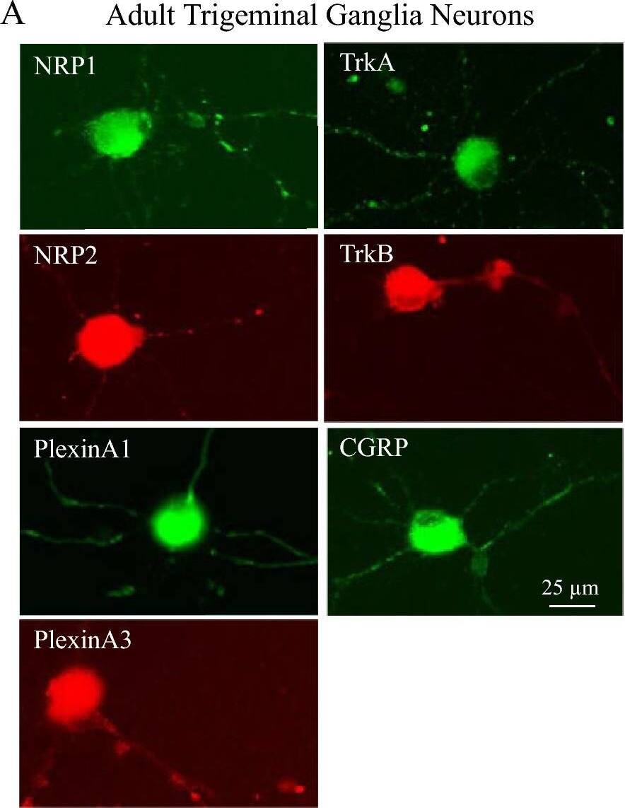 Detection of Mouse Plexin A1 by Immunocytochemistry/ Immunofluorescence