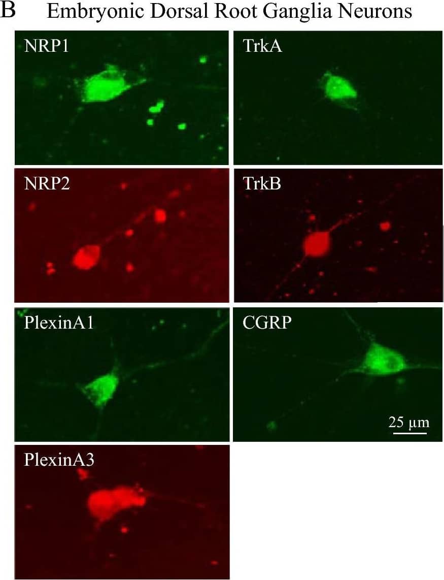 Detection of Mouse Plexin A1 by Immunocytochemistry/ Immunofluorescence