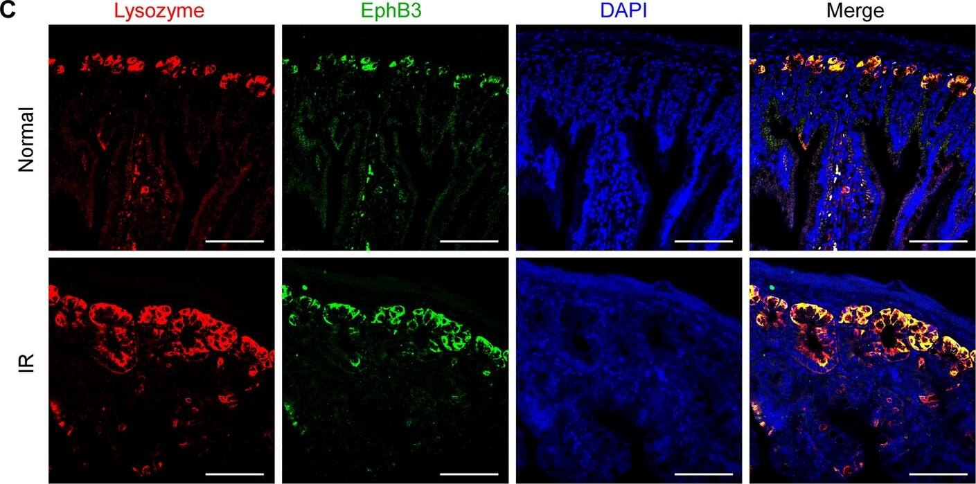 Detection of EphB3 by Immunohistochemistry
