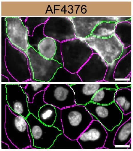 Transglutaminase 2/TGM2 Specificity is Shown by Immunocytochemistry in Knockout Cell Line.