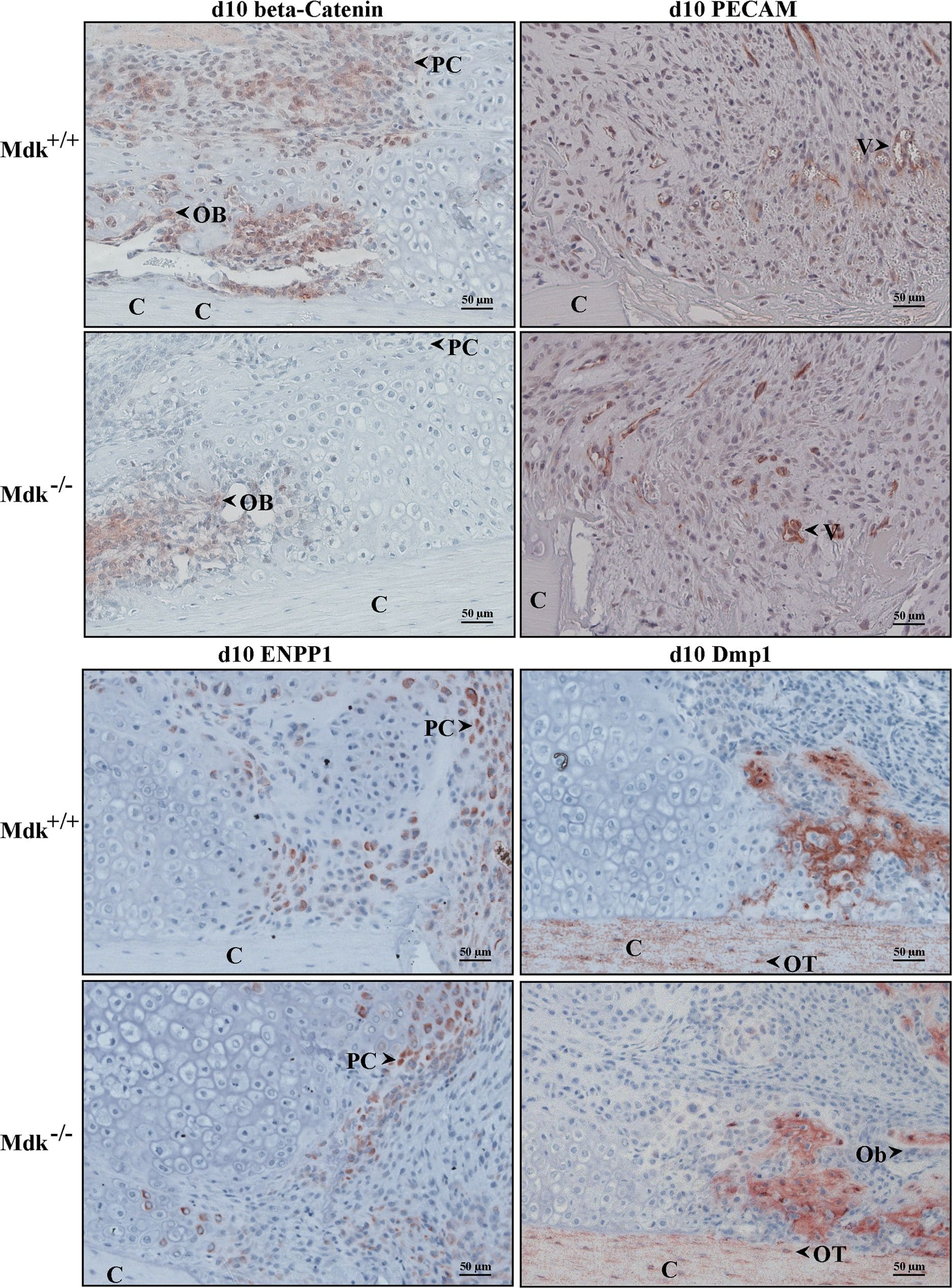 Detection of Mouse DMP-1 by Immunohistochemistry