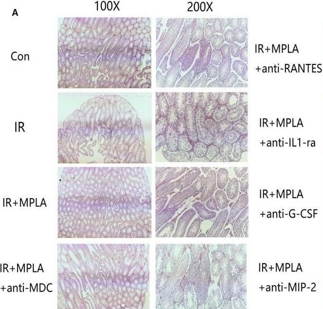 Detection of CCL22/MDC by Immunohistochemistry