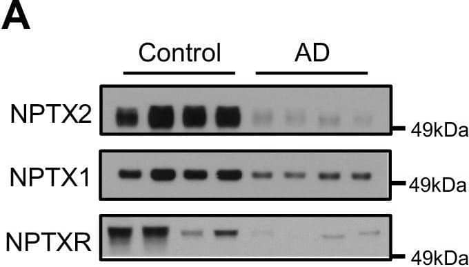 Detection of Neuronal Pentraxin R/NPTXR by Western Blot