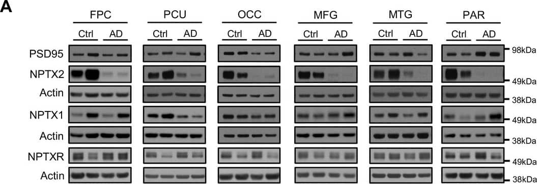 Detection of Neuronal Pentraxin R/NPTXR by Western Blot