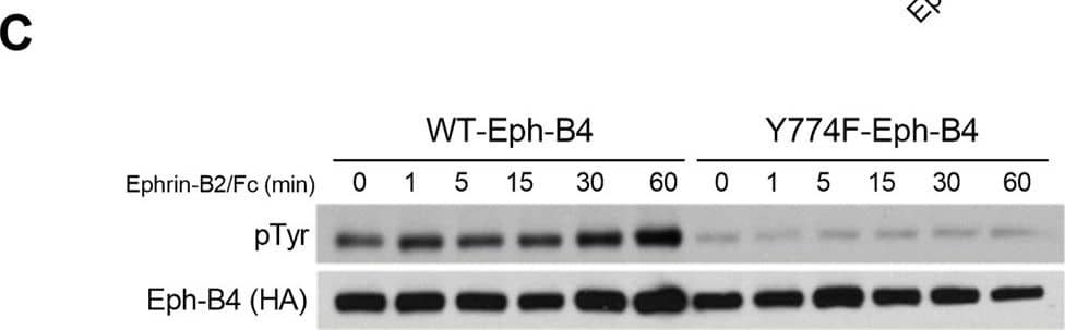 Detection of Mouse EphB4 by Western Blot