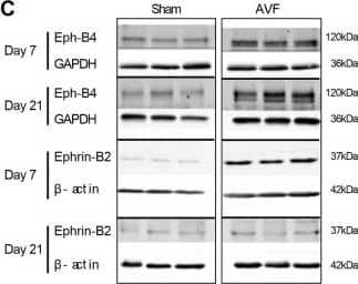 Detection of Human EphB4 by Western Blot